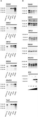 A Novel Tau Antibody Detecting the First Amino-Terminal Insert Reveals Conformational Differences Among Tau Isoforms